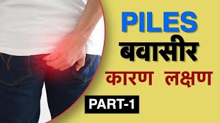 बवासीर के लक्षण क्या है  Dr Vasu  Piles symptoms in Hindi [upl. by Yancy]