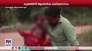 കുഞ്ഞുവീണത് മറച്ചുവച്ച് അംഗണവാടി അധികൃതര്‍ കുഞ്ഞിന് ആന്തരിക രക്തസ്രാവം Thiruvananthapuram [upl. by Ginevra997]