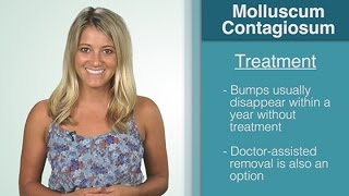 What Is  Molluscum Contagiosum [upl. by Laith]