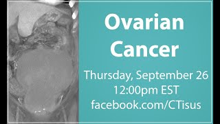 FacebookLive Ovarian Cancer [upl. by Flanders]