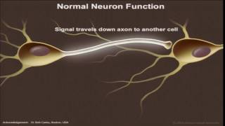 Concussion in Sport by Dr Patricios [upl. by Annayehc115]