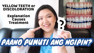 HOW TO WHITEN YOUR TEETH in an AFFORDABLE WAY 🦷✨  Dr Bianca Beley [upl. by Joub]