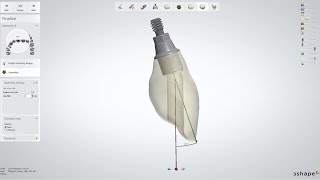 Changing the Angle of Implant Screw Channels Using Digital Design Software [upl. by Ekle]