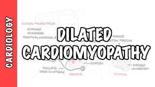 Dilated Cardiomyopathy  causes symptoms pathophysiology and treatment [upl. by Anuahsal570]