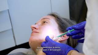 TREATMENT Confidence Booster® COLLAGEN amp Botox behandeling [upl. by Nawuj]