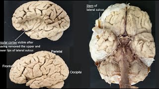 Lateral sulcus [upl. by Okiman422]