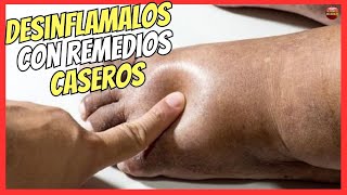 🔴 ¿COMO DESINFLAMAR LOS PIES HINCHADOS CON REMEDIOS CASEROS 🔥 [upl. by Tanny]