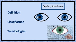 Squint  Definition Classification amp Terminologies [upl. by Hera]