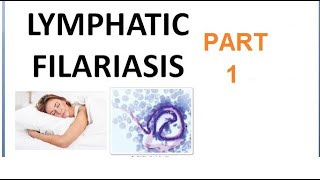 Parasitology 221 a Wuchereria Bancrofti Filariasis Filarial worm Elephantiasis Culex Microfilaria [upl. by Aloibaf]