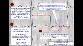 Prosty sposób obliczania QTc w EKG [upl. by Picco720]