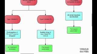 Arrhythmias Flowchart USMLE Step 2 CK [upl. by Dnalloh]