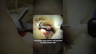 Momos Cryosurgery shorts cryosurgery veterinaryophthalmology [upl. by Nigrom357]