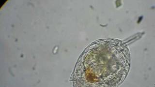 rotifer feeding on algae [upl. by Yornek]