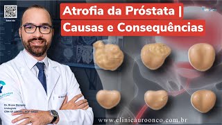 Atrofia da Próstata  O que muitos homens não sabem sobre o problema e como afeta o PSA Entenda [upl. by Louisette935]