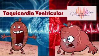 Taquicardia Ventricular Taquiarritmia de QRS Ancho y Regular [upl. by Ahgiela202]