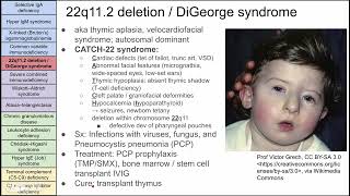 Primary immunodeficiency disorders [upl. by Naliorf748]