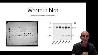 What is a Western Blot and how does it work [upl. by Dragoon]