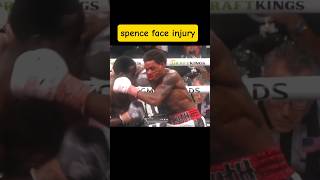 Errol spence vs crowford spencevscrawford spence crawford boxing fyp davis [upl. by Atenik]