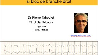 4g Bloc de branche droit 3 ischémie aiguë et infarctus P Taboulet [upl. by Maribel]