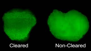 Tissue Clearing of HepG2 Spheroids for HCS [upl. by Miru]