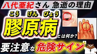 放置厳禁！知らないと後悔する「膠原病」が引き起こす体の変化。なぜ八代亜紀さんは急逝したのか。初期の危険サインとは？医師が徹底解説！ [upl. by Aramoj826]