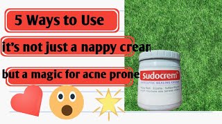 Sudo cream  Does it clear acne   is it transform your skin  Uses of Sudo cream [upl. by Alyahsat141]