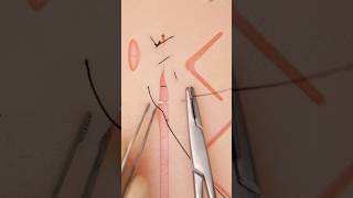 Mixed Sutures 😮 suturepractice surgery vet medicine surgeon stitches funfacts goodtoknow [upl. by Perry]