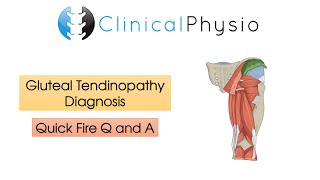 Classic Gluteal Tendinopathy Diagnosis  Clinical Physio [upl. by Astrea224]