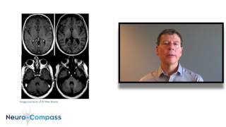 Risks of gadolinium accumulation in MRI [upl. by Daniyal]