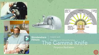 3MT Gamma Knife [upl. by Anoik]