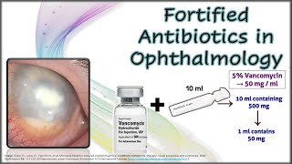 Fortified Antibiotics in Ophthalmology [upl. by Pollock]