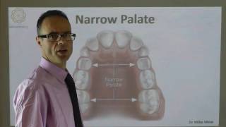 A Narrow Palate By Dr Mike Mew [upl. by Silda]