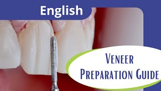 Veneer preparation guide [upl. by Carter425]