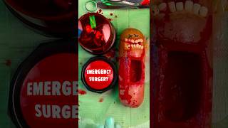 Emergency FruitSurgery  The Button is Back Giant Glizzy gives birth FoodSurgery DiscountDentist [upl. by Glavin840]