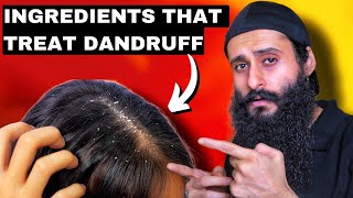 AntiDandruff Ingredients That You Should Know  Bearded Chokra [upl. by Emiaj]