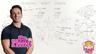 Ischemic Heart Disease Coronary Artery Disease [upl. by Annaiuq]