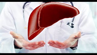 New Long case of Chronic Liver Disease Presentation with explanation [upl. by Meda]