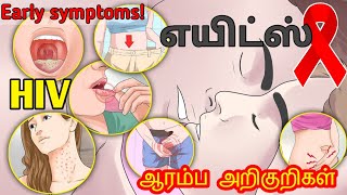 AIDS symptoms in TamilAIDS in Tamilhiv explained in tamilaids explained tamilhiv symptoms tamil [upl. by Beverlee]