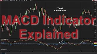 How to Use the MACD Indicator Moving Average Convergence Divergence [upl. by Anelas]