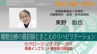 国際医療福祉大学病院 オンライン市民公開講座 難聴治療の最前線ときこえのリハビリテーション⑤クロージングリマークス骨導インプラント装用者の体験談2分04秒 [upl. by Ping]