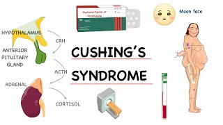 ‎⭕ شرح مفصل خطوة بخطوة لـ  Pathophysiology of Cushing’s Syndrome [upl. by Ralyt]