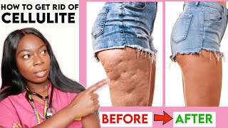 How to get rid of CELLULITE on your THIGHS LEGS amp BUTT Home Remedies Workout  Creams amp more [upl. by Atilef749]