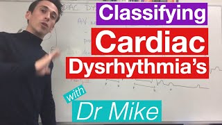 Cardiac dysrhythmias arrhythmias common [upl. by Anchie172]