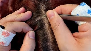 Gentle ASMR Scalp Care No Talking Soothing Dandruff Removal [upl. by Mohandas]