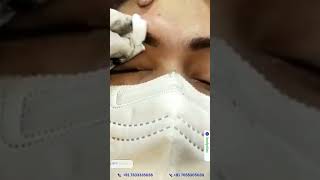 Transform Your Look with Expert Microblading at BodyClinix [upl. by Odlabu]