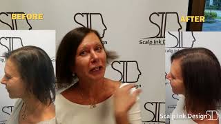 Scalp Micropigmentation for Women  Testimonial  Before and After  Hair Loss Solution [upl. by Adnilre185]