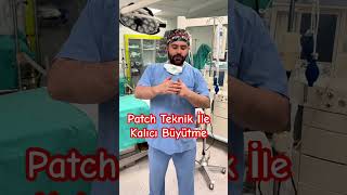 Kalıcı Büyütme Ameliyatı Patch Tekniği androloji erkeksağlığı üroloji [upl. by Asserrac]