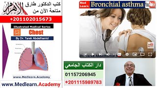 Bronchial Asthma cme internalmedicine medical usmle محاضراتباطنة [upl. by Beard]