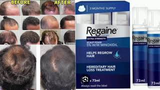 Rogaine Mens Hair Regrowth Treatment Foam [upl. by Malin544]