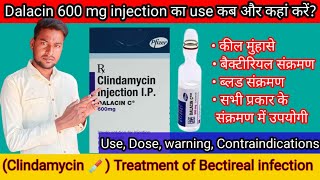 Clindamycin injectionuse कब और कहां करें पूरी जानकारीDalacin c 600mg injectionuseDosewarningquot [upl. by Akedijn481]